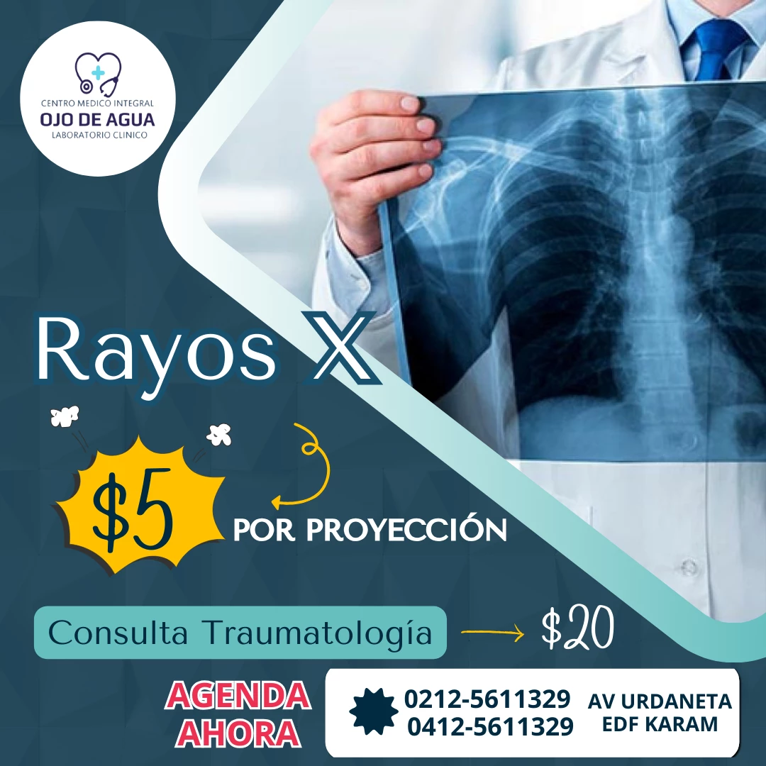 Proyección simple Rx